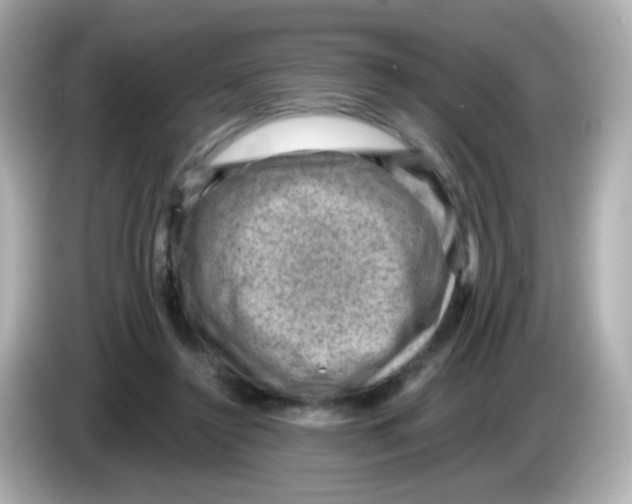 X0000085800356200704091453