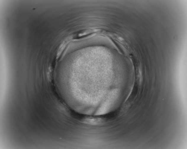 X0000085800712200704091449