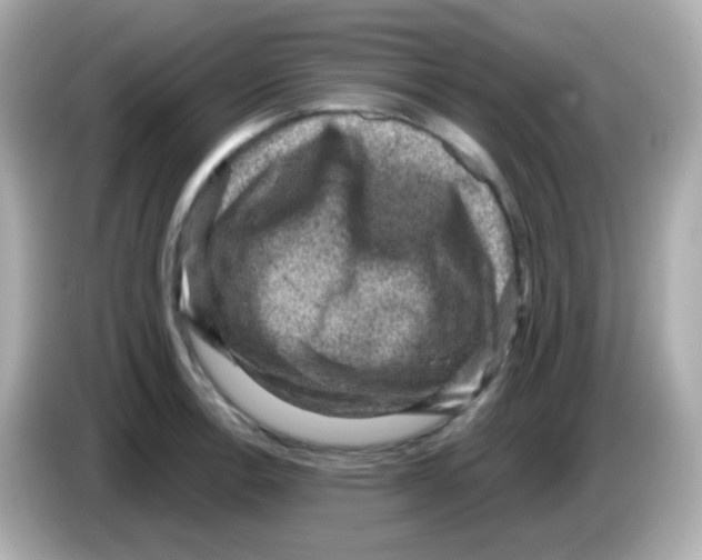 X0000085801138200704091444