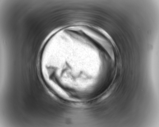 X0000085801149200704091444