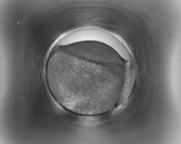 X0000085801197200704091443