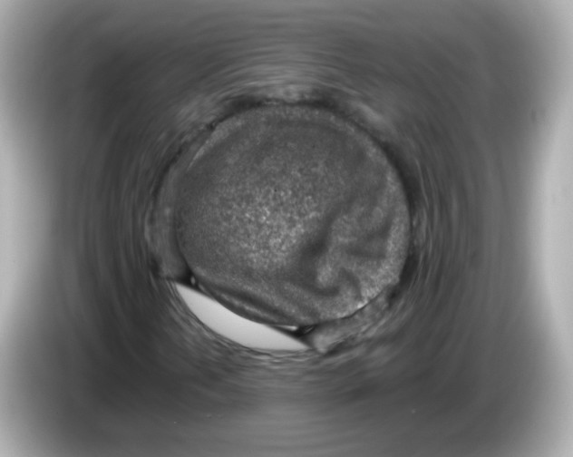 X0000085801202200704091442