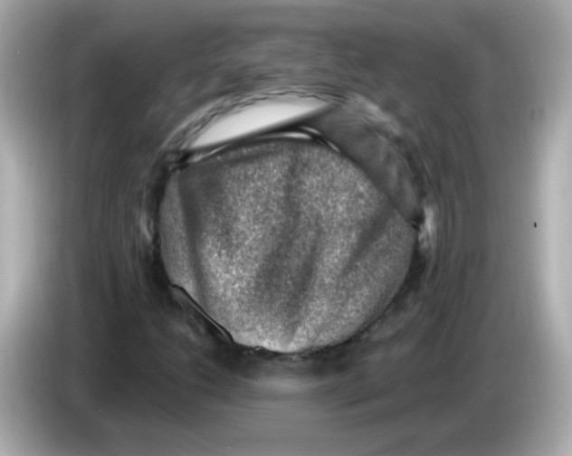 X0000085801206200704091442