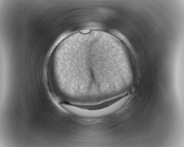 X0000085801243200704091443