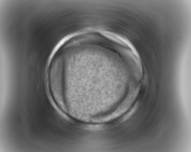 X0000085801389200704091441