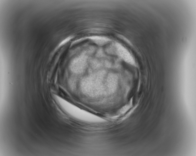 X0000085801402200704091440