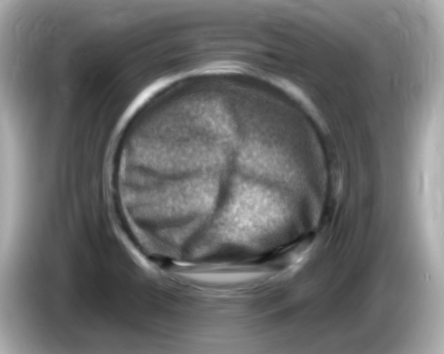 X0000085801422200704091440