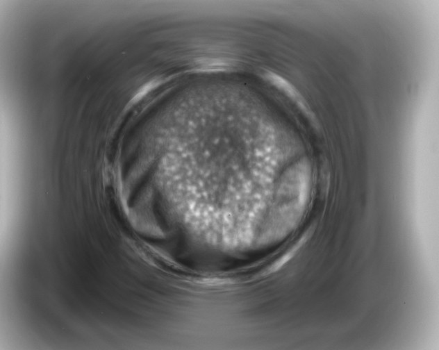 X0000085801449200704091440