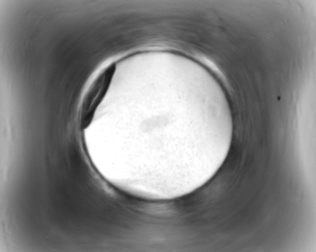 X0000085801472200704091440