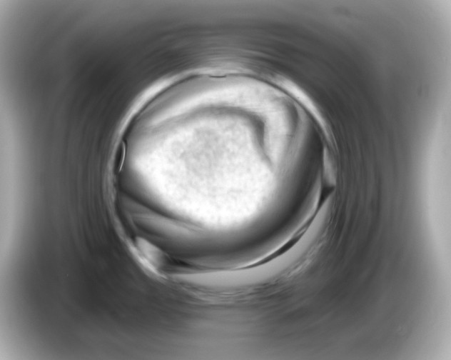 X0000085801485200704091439