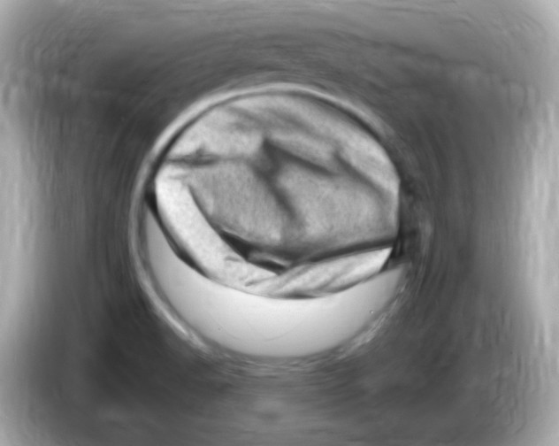 X0000085801518200704091439