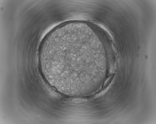 X0000085801077200704131915