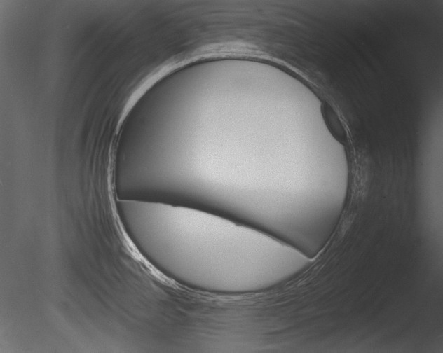 X0000085811390200703161017