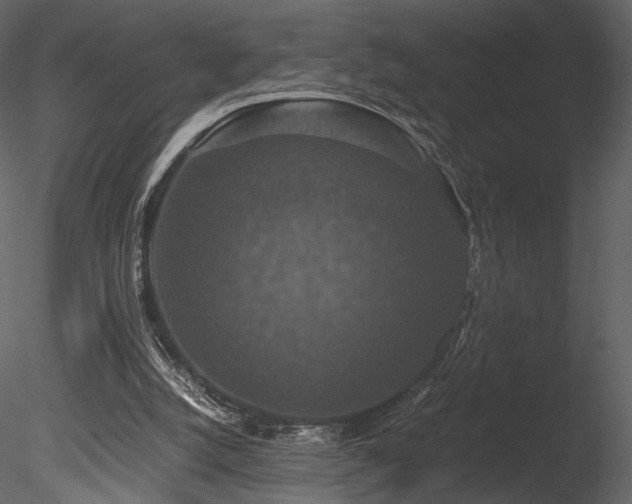 X0000085810056200703161207