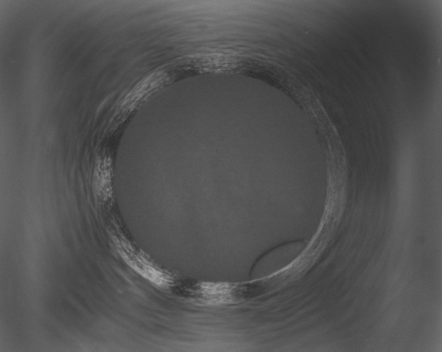 X0000085810144200703161206