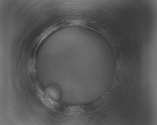 X0000085810146200703161205