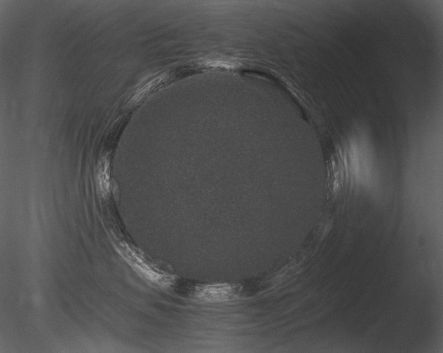 X0000085810479200703161200