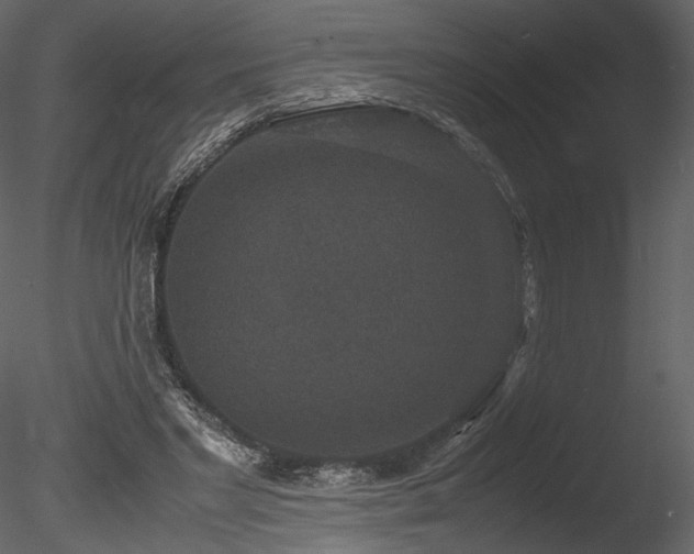 X0000085810493200703161159