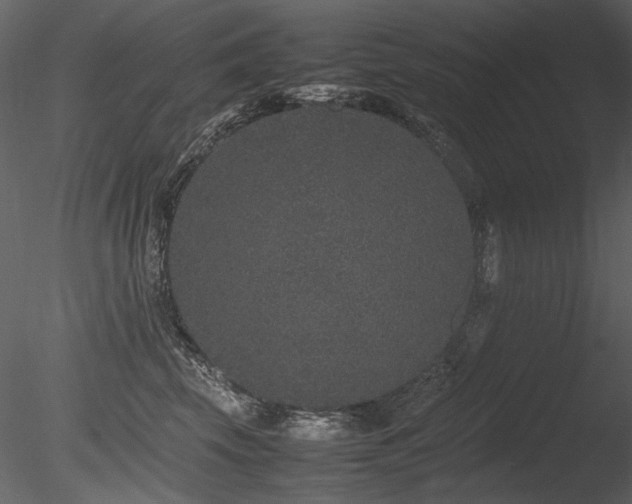 X0000085810569200703161158