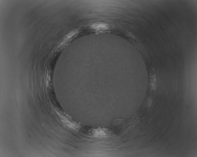 X0000085810618200703161157