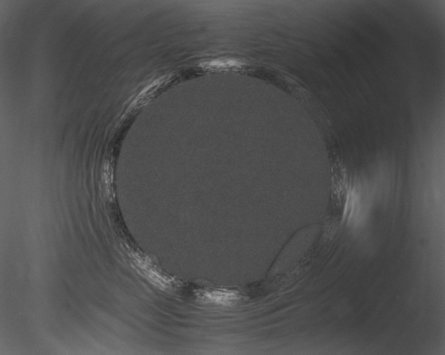 X0000085810669200703161157