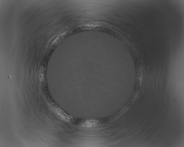 X0000085810758200703161155