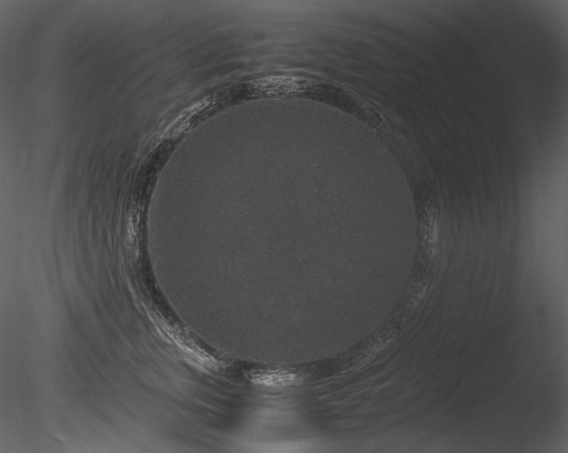 X0000085810759200703161155