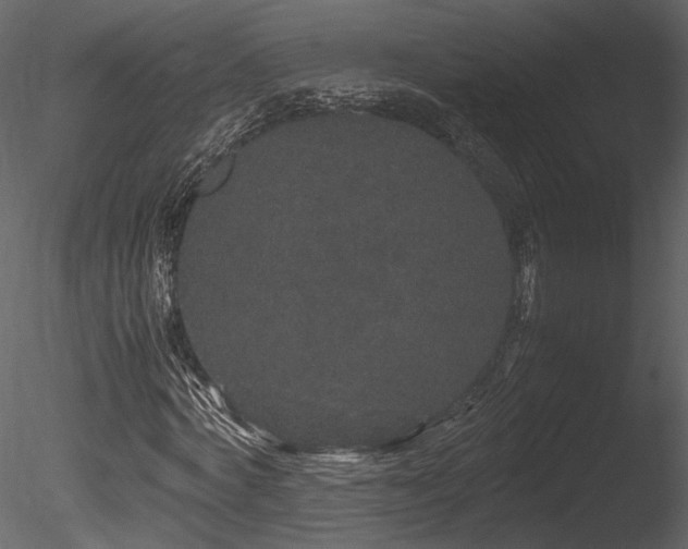 X0000085810772200703161154