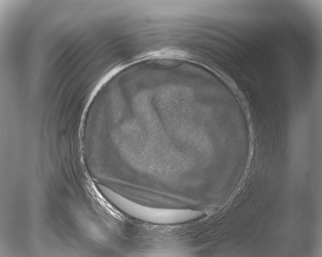 X0000085811248200703301517