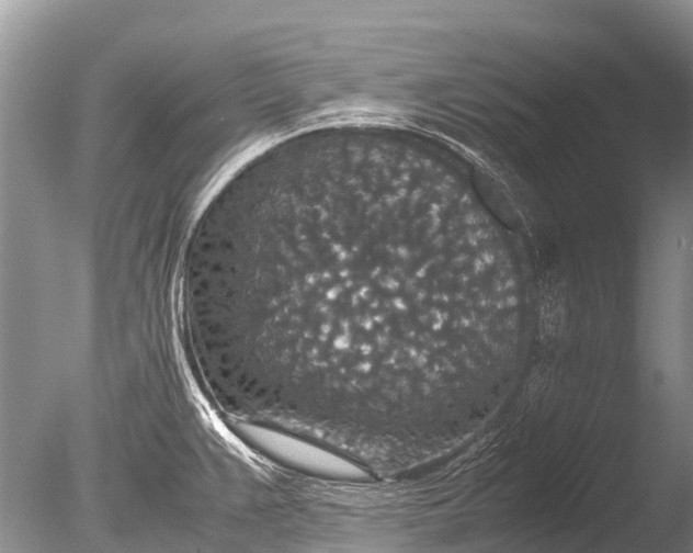 X0000085811383200703301513