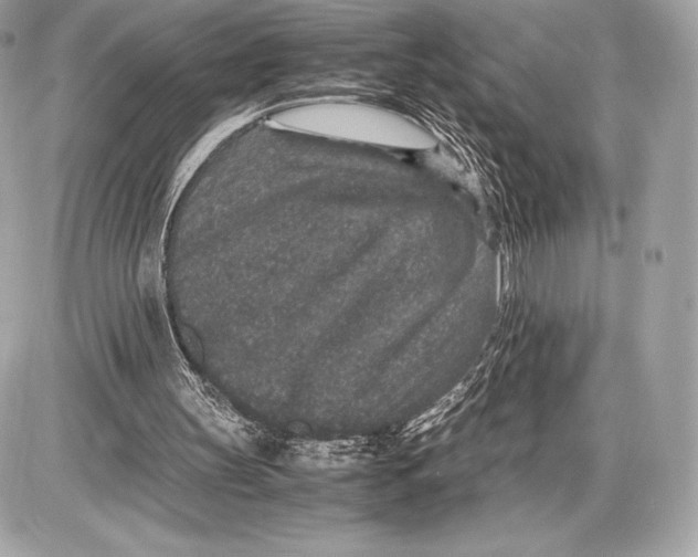 X0000085810147200704091615