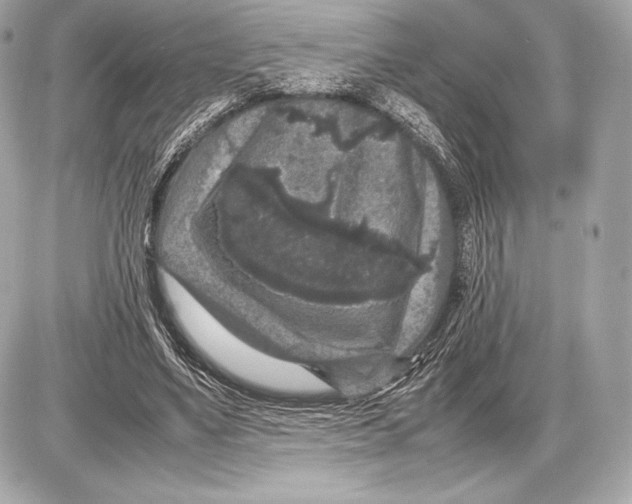 X0000085810491200704091610