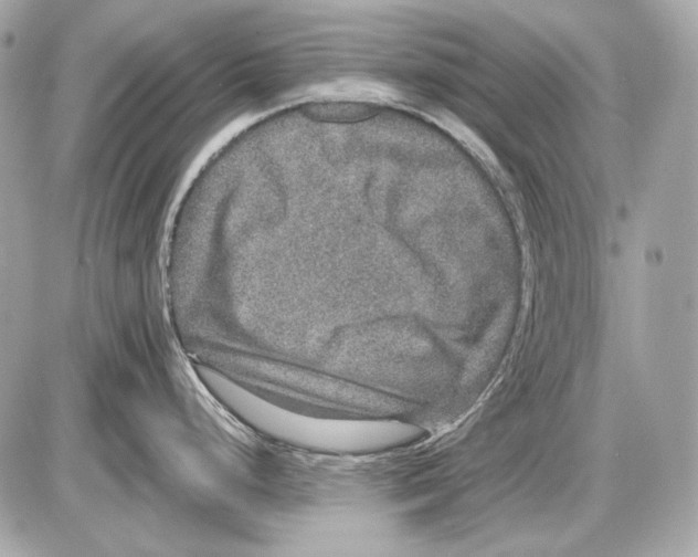 X0000085811248200704091558