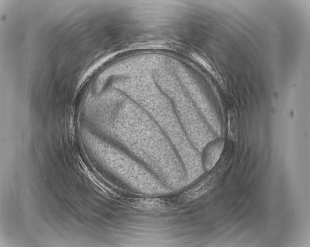 X0000085811452200704091554