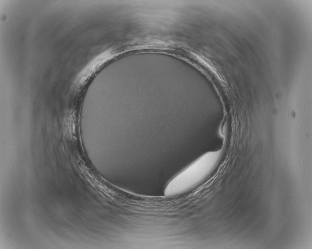 X0000085811455200704091554