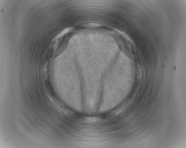 X0000085810360200704131952