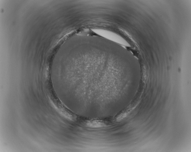 X0000085810451200704131951