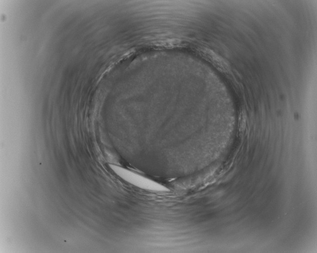 X0000085811202200704131938