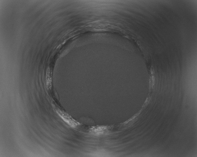 X0000085820186200703161232