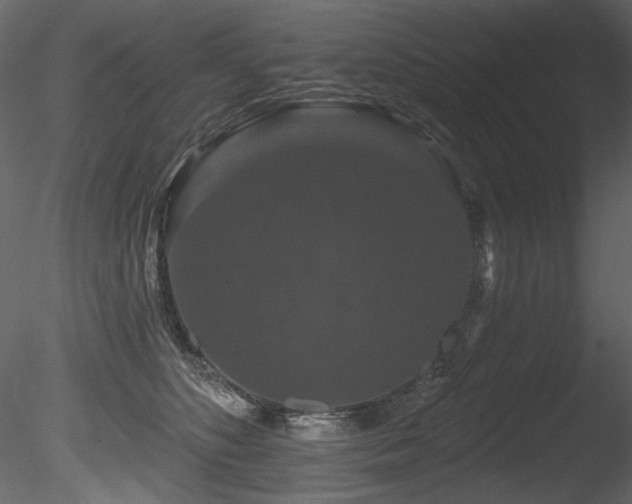 X0000085820516200703161226