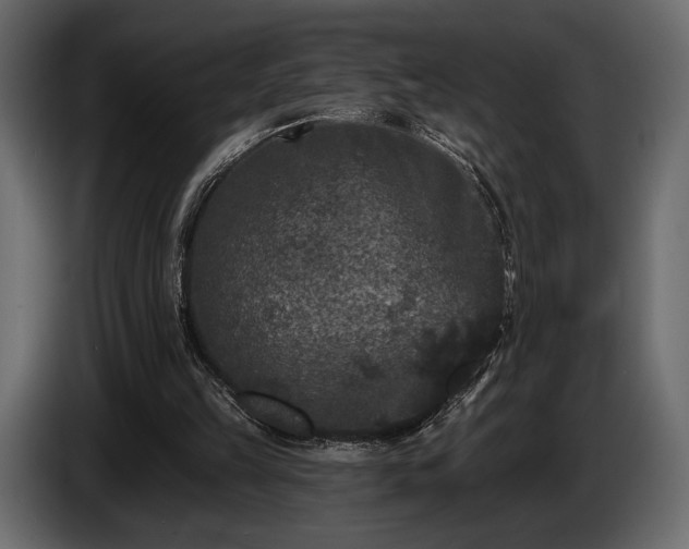 X0000085820149200703231405