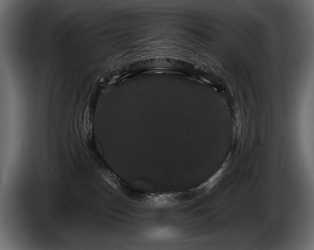 X0000085820186200703231406