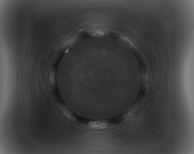 X0000085820331200703231403
