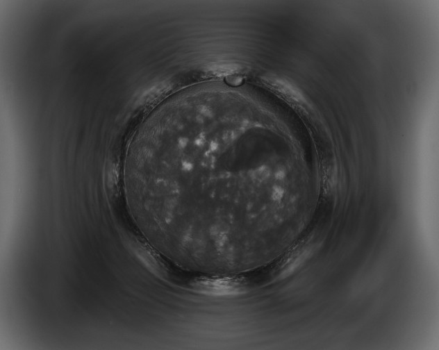 X0000085820365200703231403