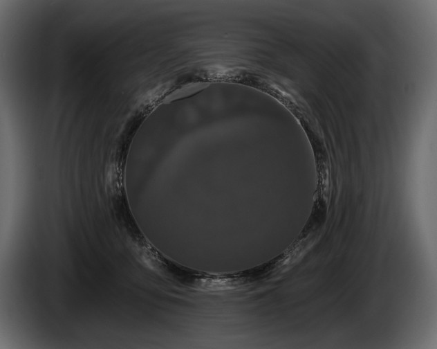 X0000085820419200703231401