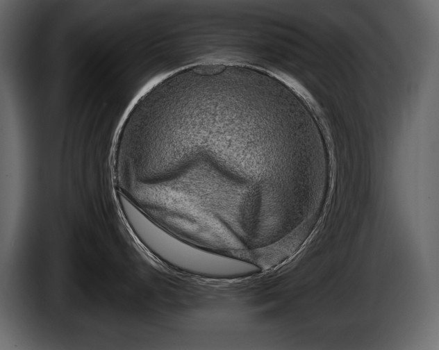 X0000085821248200703231350