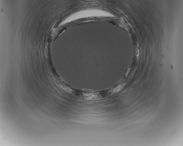 X0000085820516200703301557