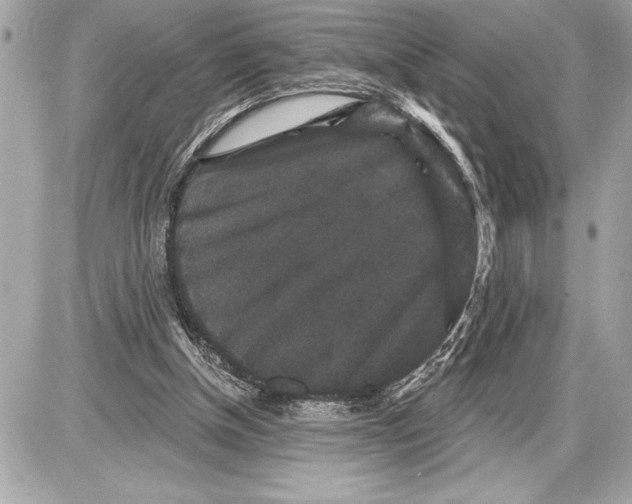 X0000085820154200704091641