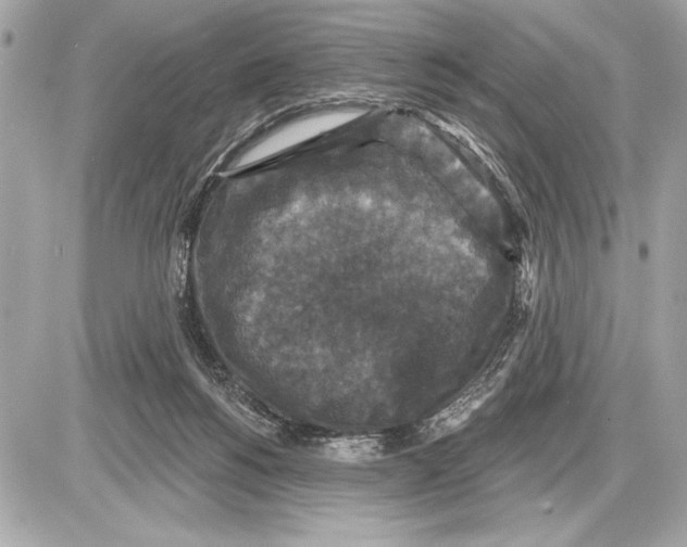 X0000085820168200704091641