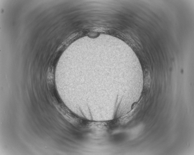 X0000085820179200704091641